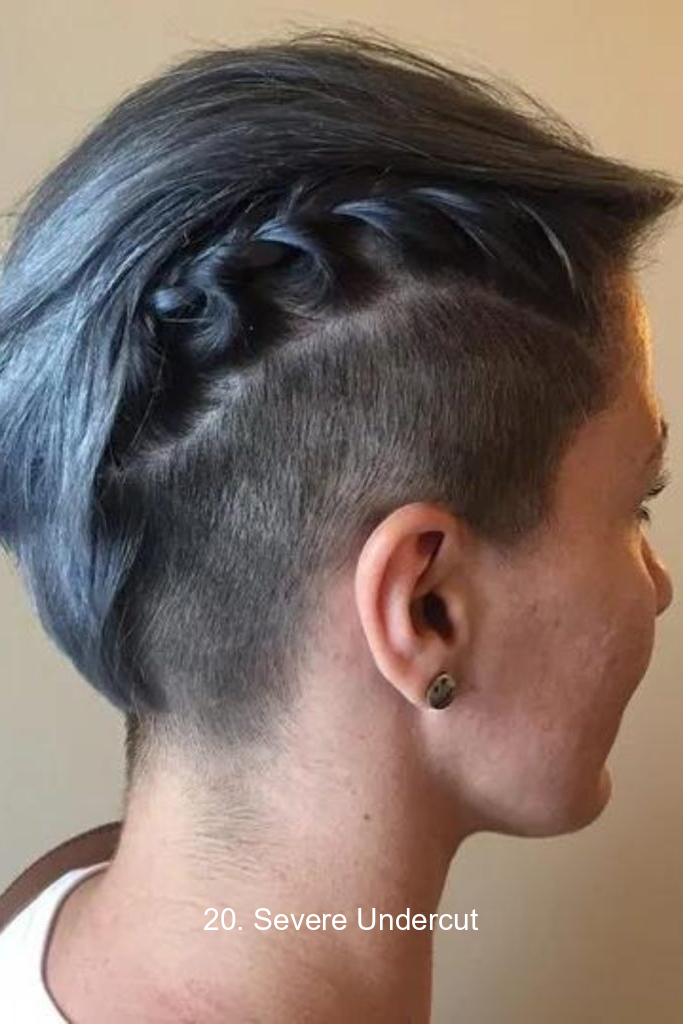 20. Severe Undercut